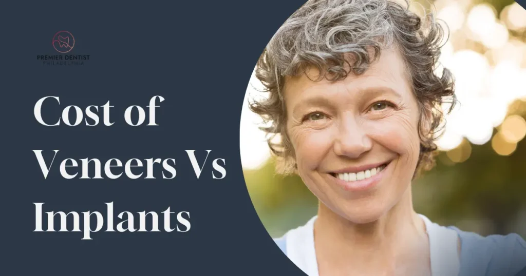 Cost Of Veneers Vs Implants Blog Header